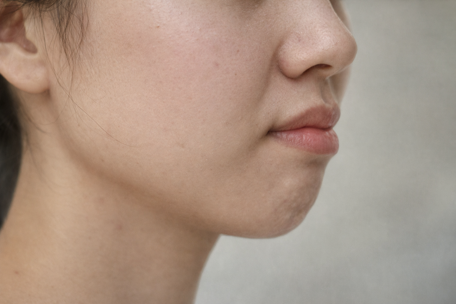 옆모습 심미 고민