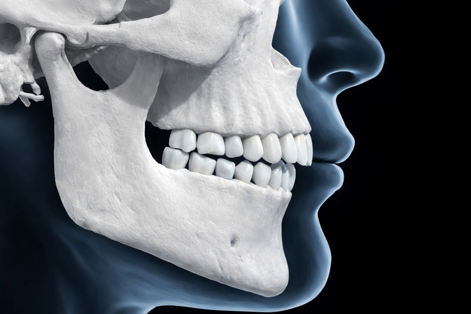 돌출입 교정 필요성