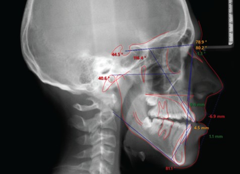 구호흡 교정 필요성