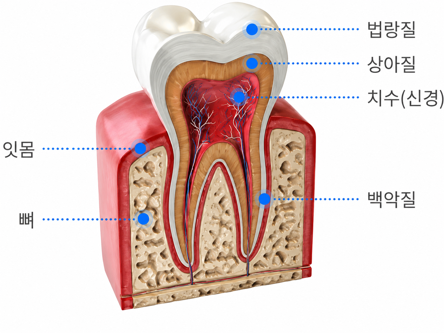 신경치료 치아 교정 오해